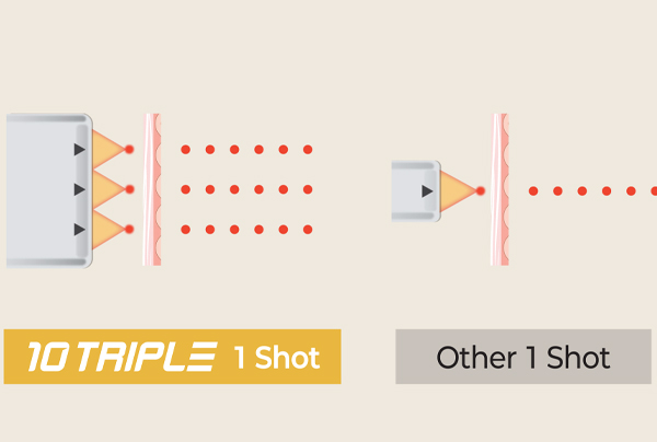 텐트리플리프팅