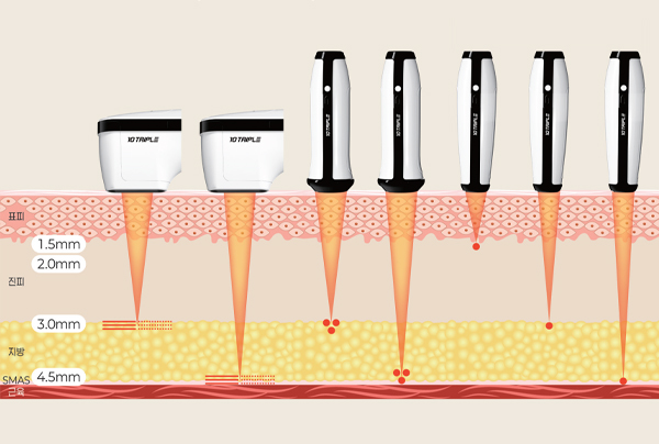 텐트리플리프팅